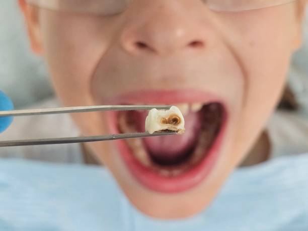 Best Emergency Treatment for Oral Infections in Whitg, IN