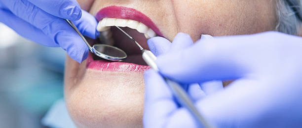 Best Emergency Wisdom Tooth Extraction in Whitg, IN